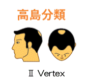 Ⅱ　Vertex